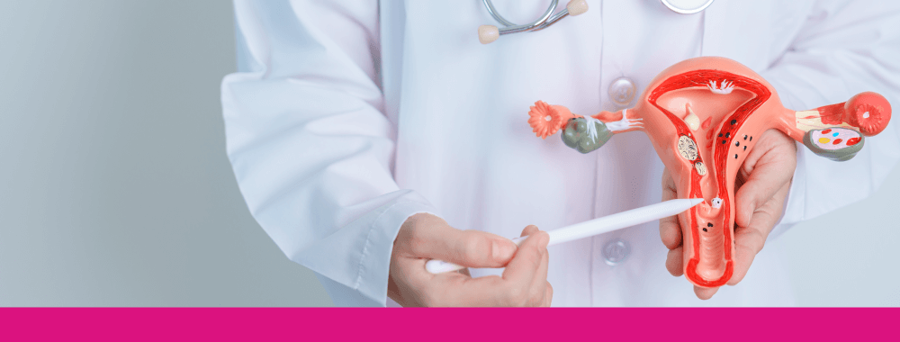 Cáncer de ovario: estadísticas y factores de riesgo