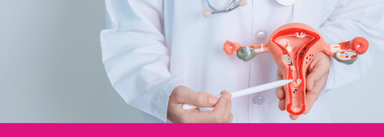 Cáncer de ovario: estadísticas y factores de riesgo